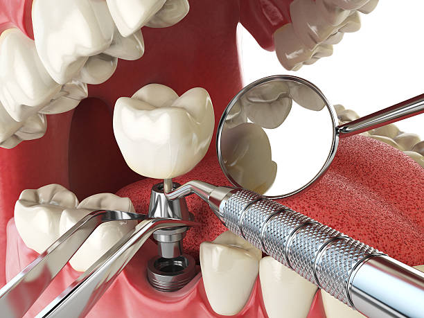Best Cracked Tooth Emergency Dentist  in Brookfield, MO